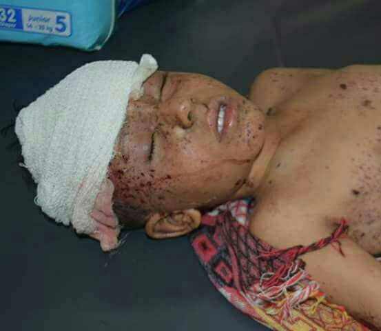 Photo of الغام مليشيا الحوثي تقتل٣ فتيات بلحج وطفلين بالحديدة
