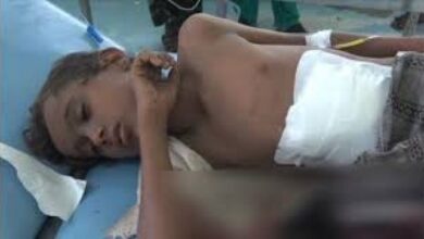 Photo of إصابة طفلين بانفجار مقذوف من مخلفات الحوثيين في الحديدة