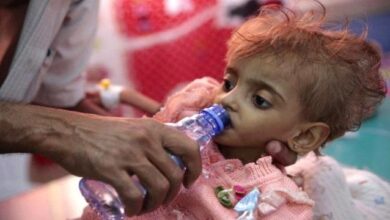 Photo of الدفتيريا تتصدر قائمة الأوبئة الأكثر حصدا لأرواح اليمنيين